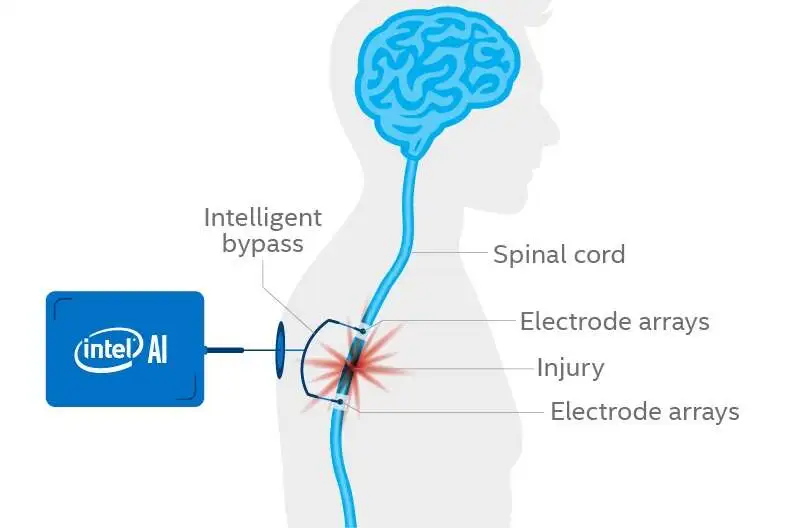 Intelligent Spine Interface